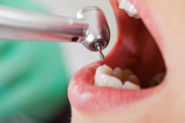 Best Weekend Emergency Dentist in Keyes, CA